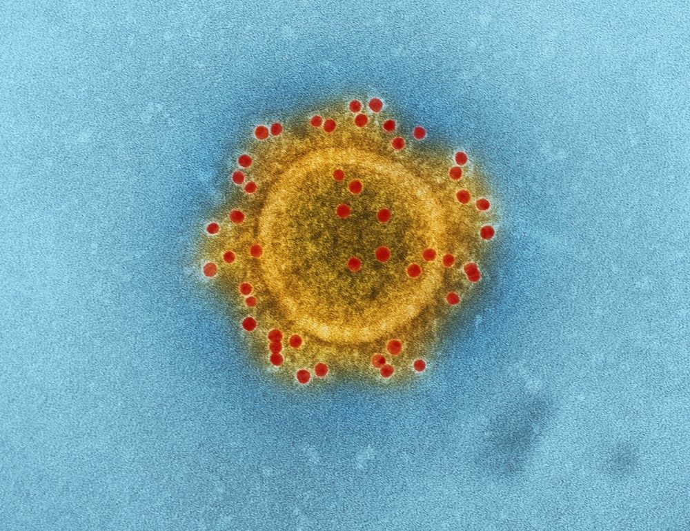 image of respiratory syndrome coronavirus (MERS-CoV) virion